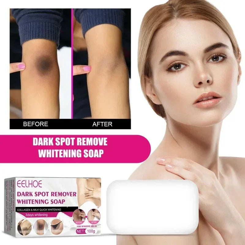 Skin Whitening Soap – Brighten Underarms, Knees & Dark Spots