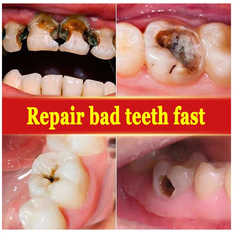 Probiotic Whitening Toothpaste – SP4 Cavity Repair