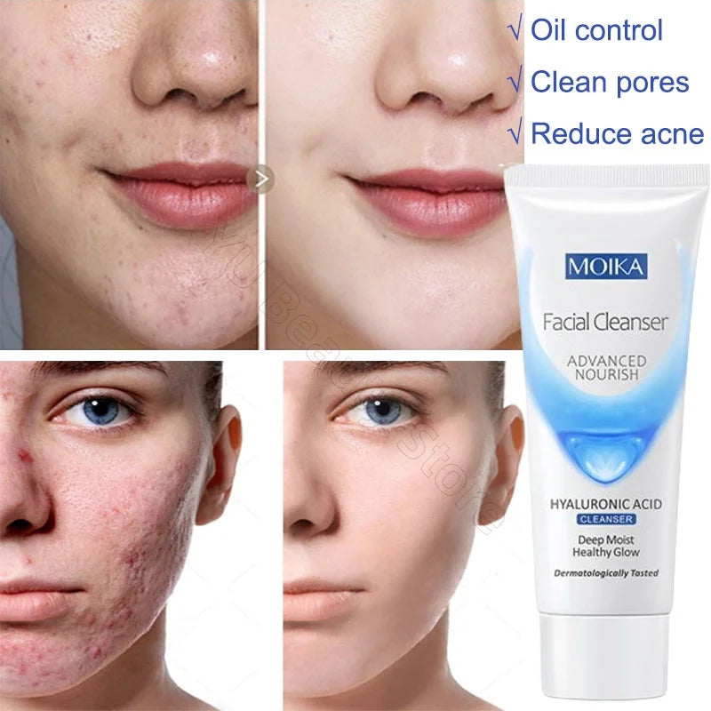 Facial Foam Cleanser 80g –  Whitening Moisturizer
